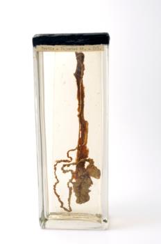 TESTIS, spermatic cord